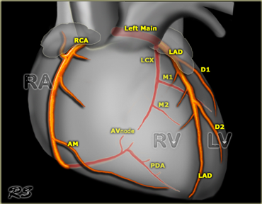 RCA, LAD and Cx in the anterior projection