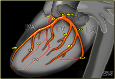 RCA, LAD and Cx in the lateral projection