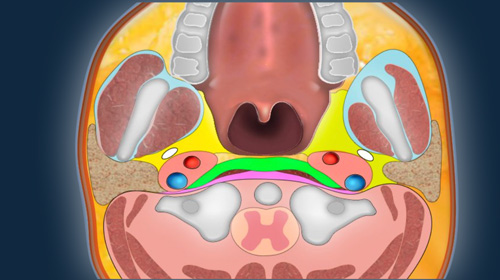 Suprahyoid Neck - MR Anatomy and Pathology