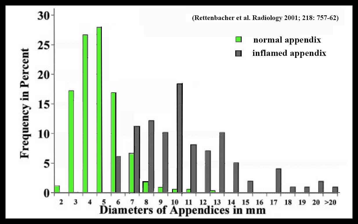 The Radiology Assistant : Appendicitis - US findings
