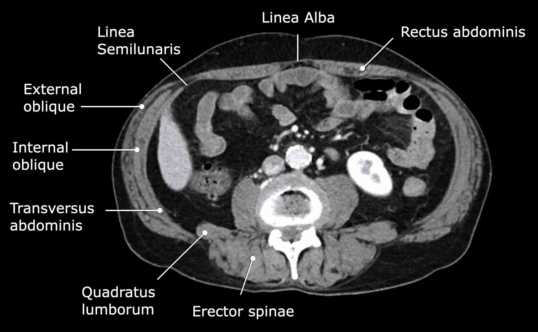 Muscles Of The Posterior Abdominal Wall