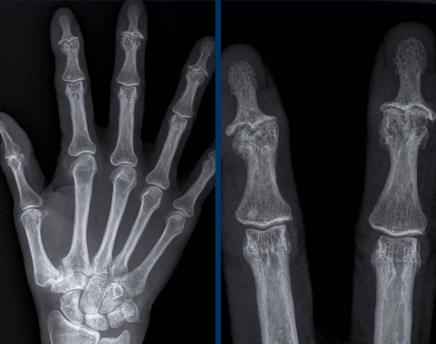 The Radiology Assistant Arthritis
