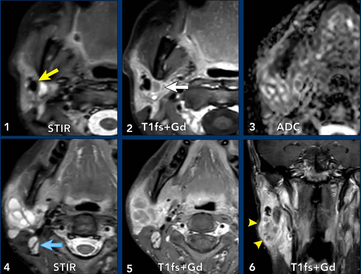 Click on image for an enlarged view