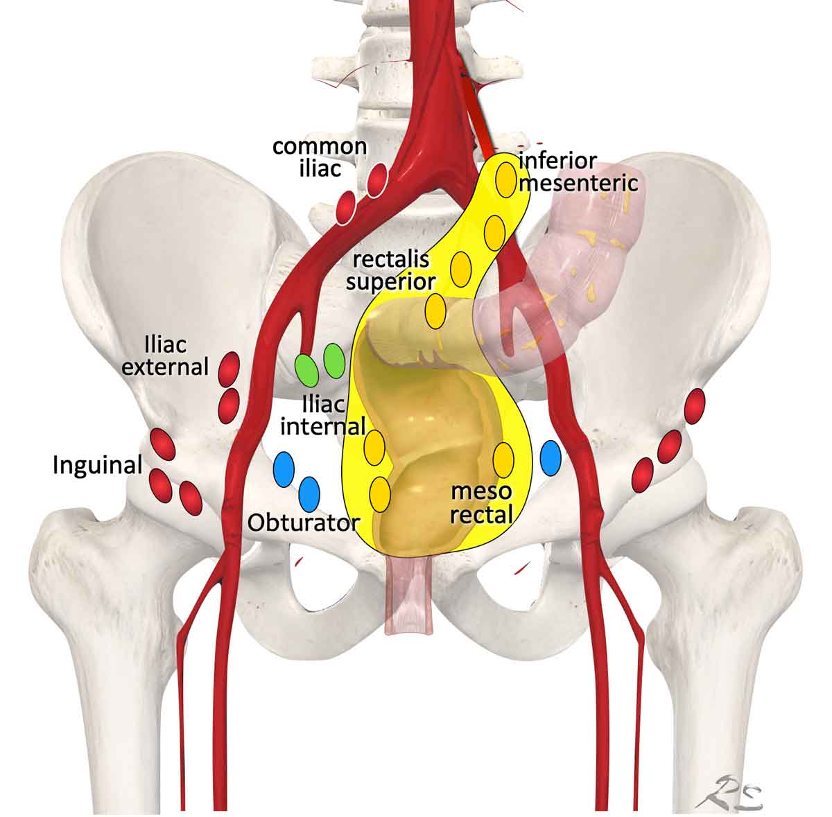 Regional lymph node drainage. The lymph nodes in red are all non, regional (M-stage) nodes. In TME only the mesorectal nodes and in high rectal tumors also the rectalis superior and inferior mesenteric nodes are excised.