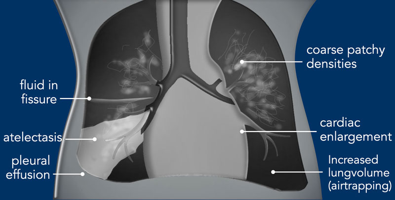 The Radiology Assistant : Neonatal Chest