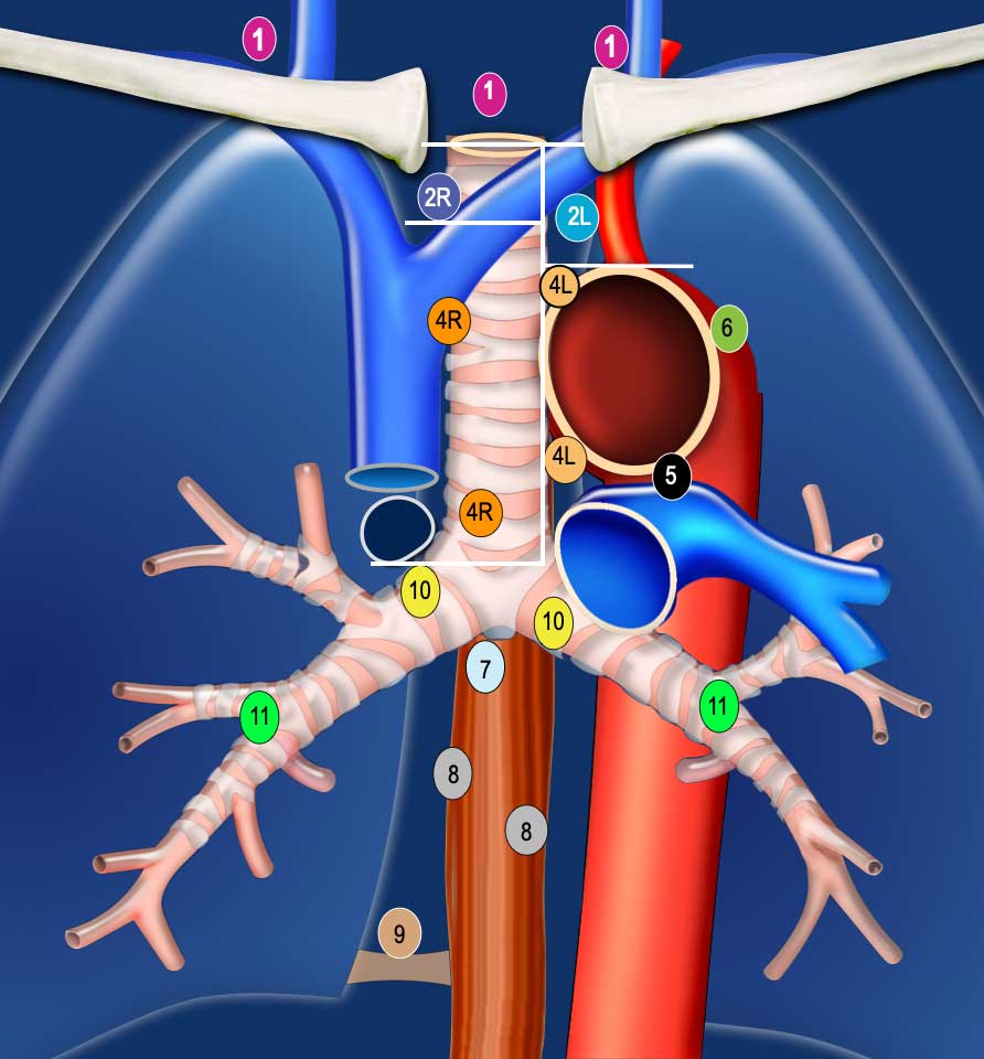 Adapted from the American Thoracic Society mapping scheme