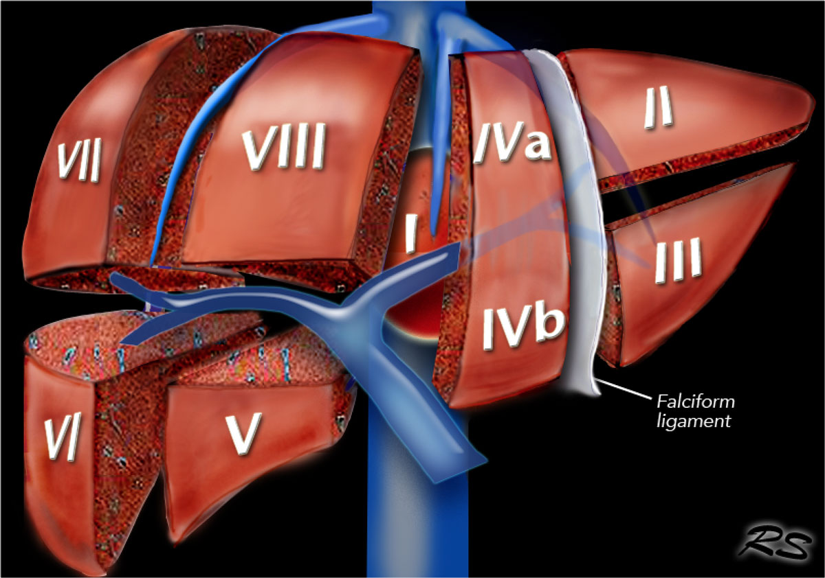 The Radiology Assistant : Liver - Segmental anatomy