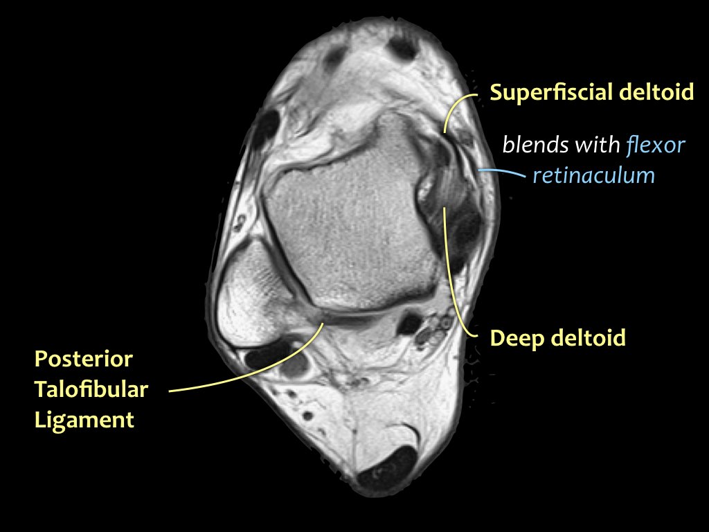 The Radiology Assistant : Ankle - MRI examination