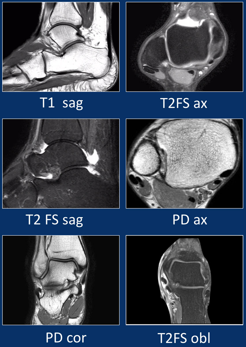 The Radiology Assistant Ankle MRI examination