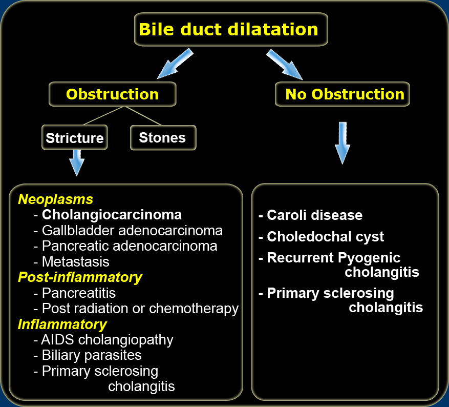 bile duct dilation symptoms
