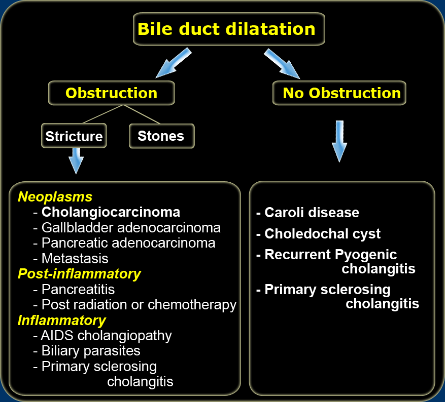 klatskin tumor stages of