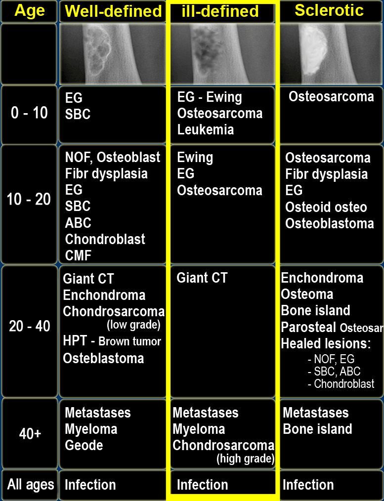 Osteoclastoma Symptoms