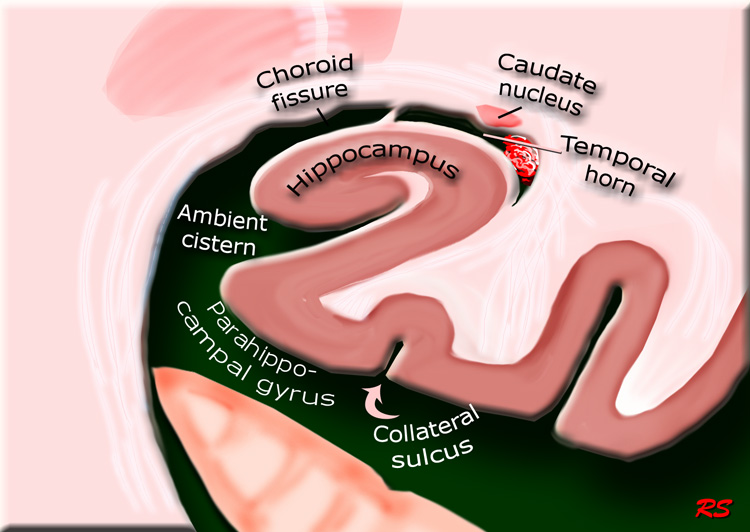 Hippo Campus Anatomy Radiology