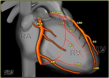 RCA, LAD and Cx in the right anterior oblique projection