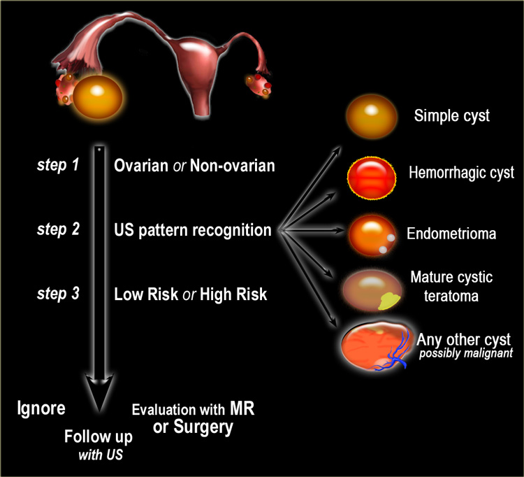 Ovarian Tumor Size Chart