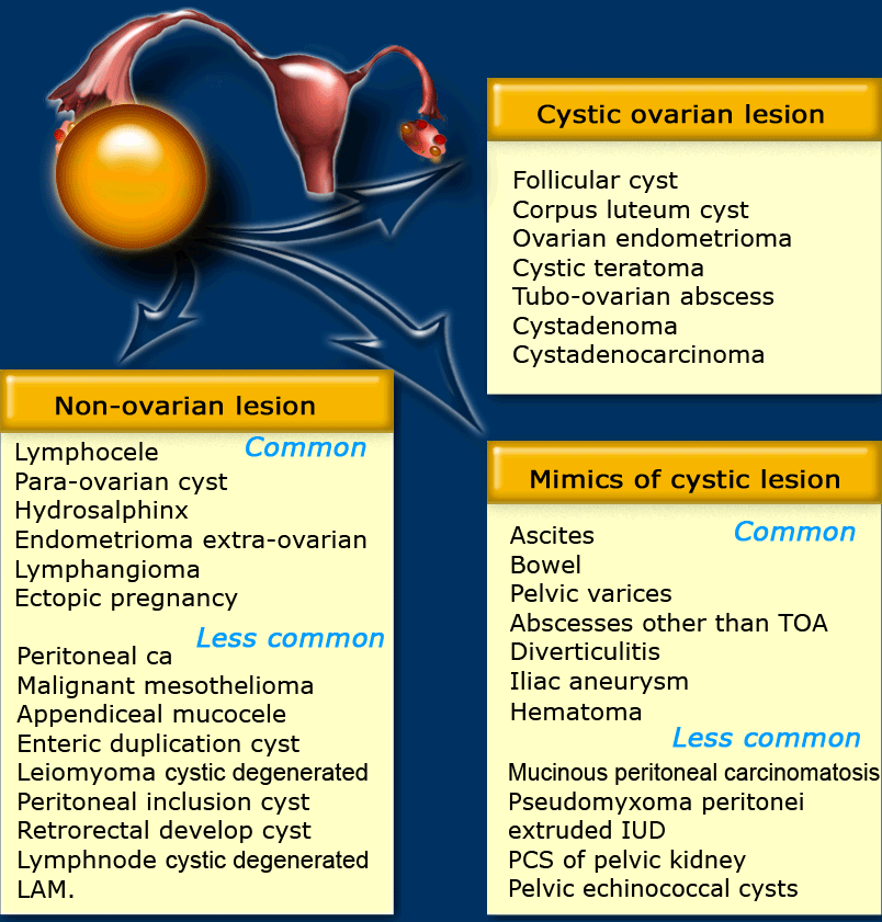 Ovarian Cyst Size Chart