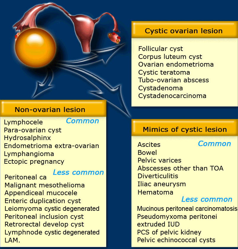 Ovarian Mass Size Chart