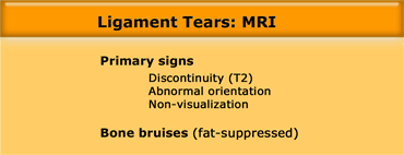 MR-signs of ligament tear