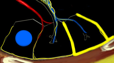 Centrilobular area in blue and perilymphatic area in yellow.