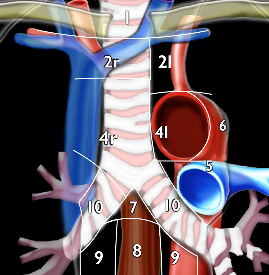 The Radiology Assistant : Mediastinum - Lymph Node Map