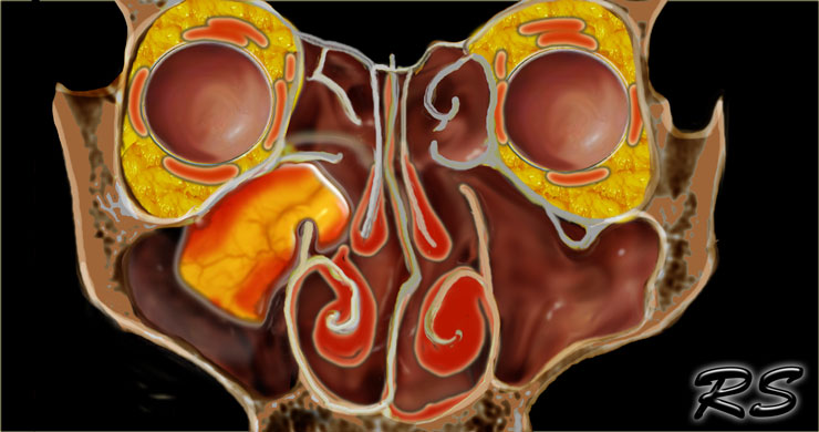 The Radiology Assistant Mri Examination