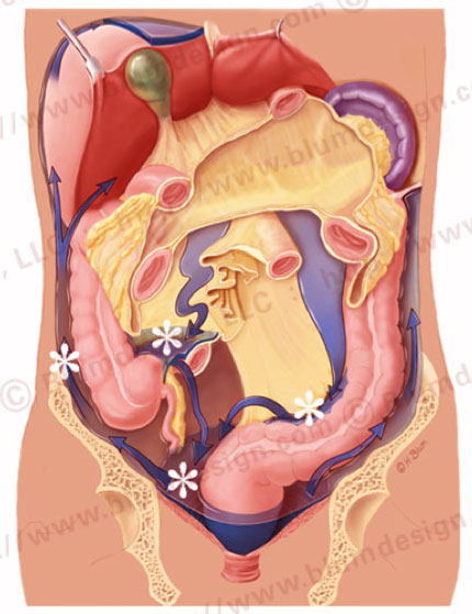 Peritoneal pathways
