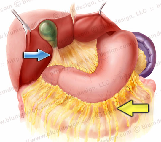 Gastrocolic ligament (yellow arrow), gastrosplenic ligament, gastrohepatic ligament and hepatoduodenal ligament (blue arrow