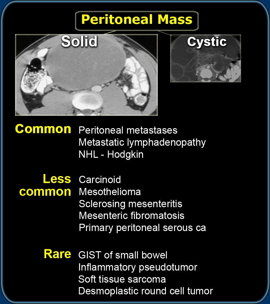 Differential diagnosis of solid peritoneal masses