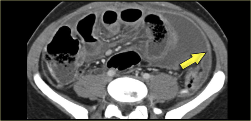 prognosis for inoperable mesothelioma