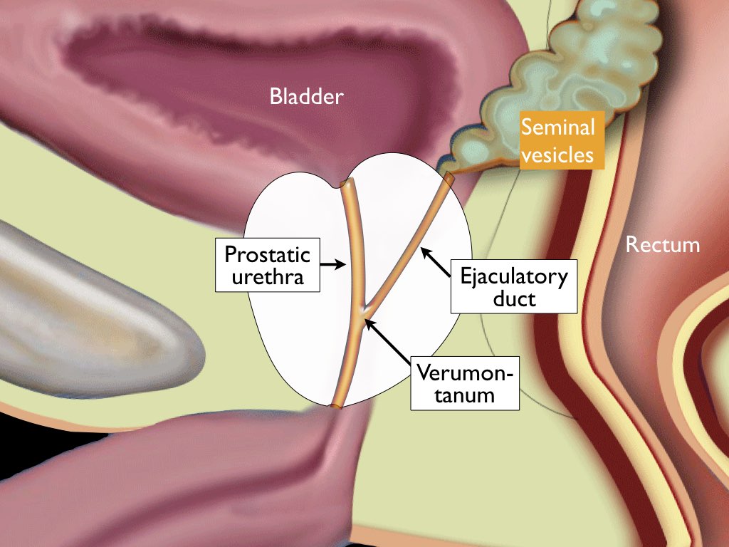 Ant prostatitis kezelése - Ant prostatitis kezelése. Heveny prosztata gyulladás | Urológiai Klinika