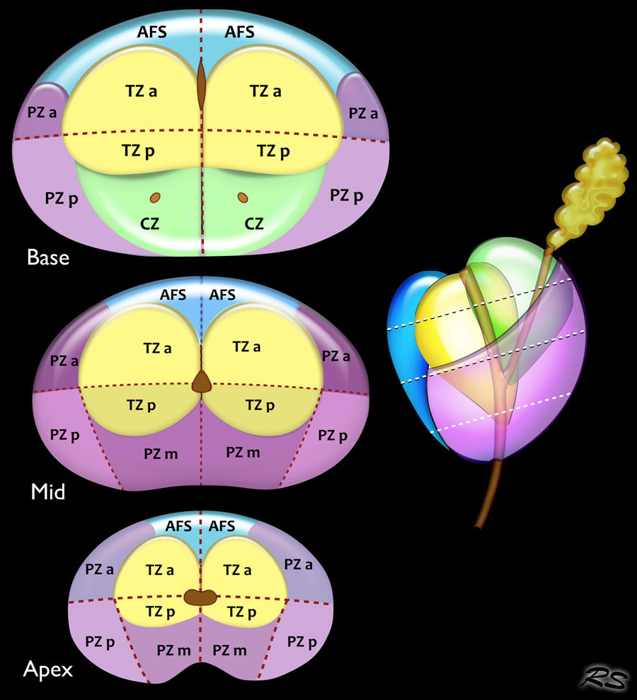 MULTIPARAMETRIC MR IMAGING OF PROSTATE TUMORS: PI-RADS V | SCIENTIFIC JOURNAL OF THE