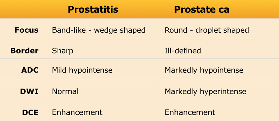 prostatitis symptoms vs prostate cancer
