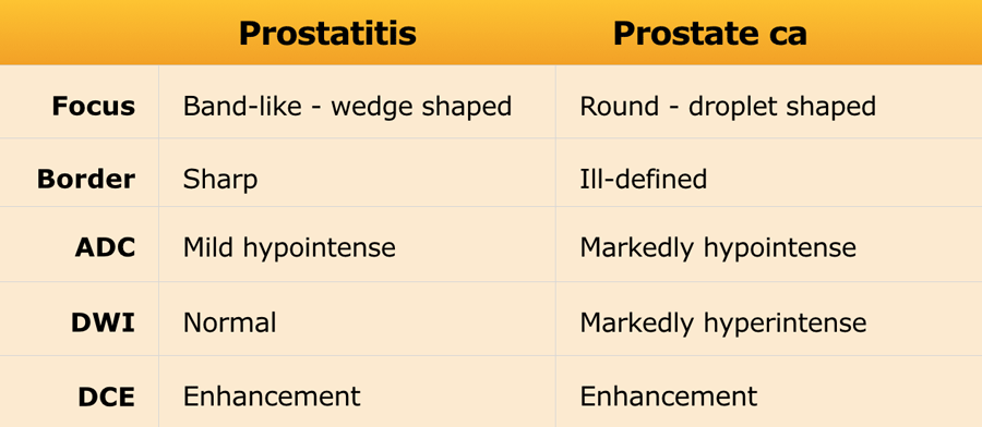 acute prostatitis and prostate cancer