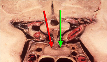 Hypothalamus hormones either stimulate (green arrow) or inhibit (red arrow) the production of pituitary hormones.
