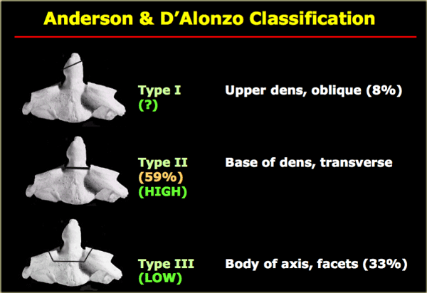 icd 10 code for type 1 odontoid fracture