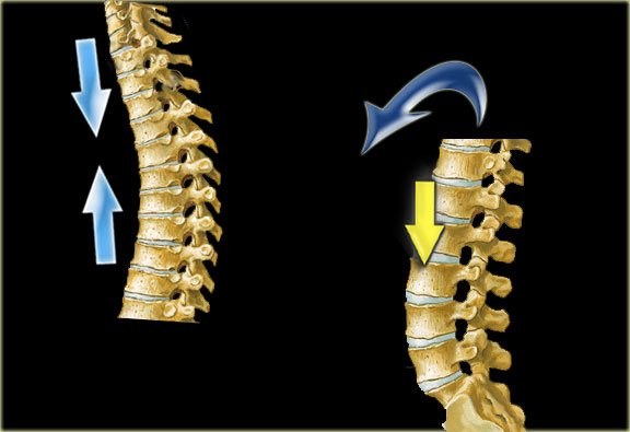 In the thoracic region flexion injuries predominate. In the lumbar region burst fractures predominate.