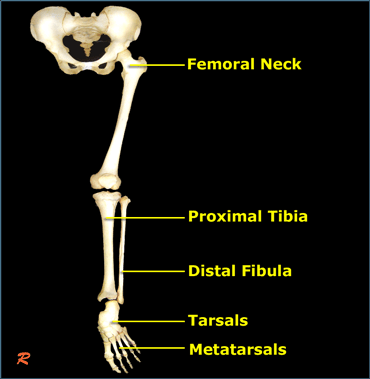 Mo Bamba Left Leg: Tibial Stress Fracture