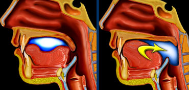 LEFT: Oral or preparatory phase. RIGHT: Transport to pharynx and subsequent triggering of the actual swallowing reflex.