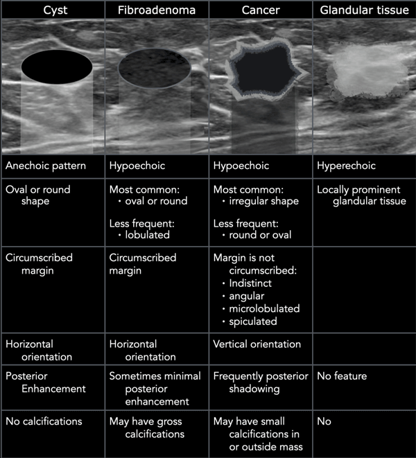 Breast Anatomy - Radiology