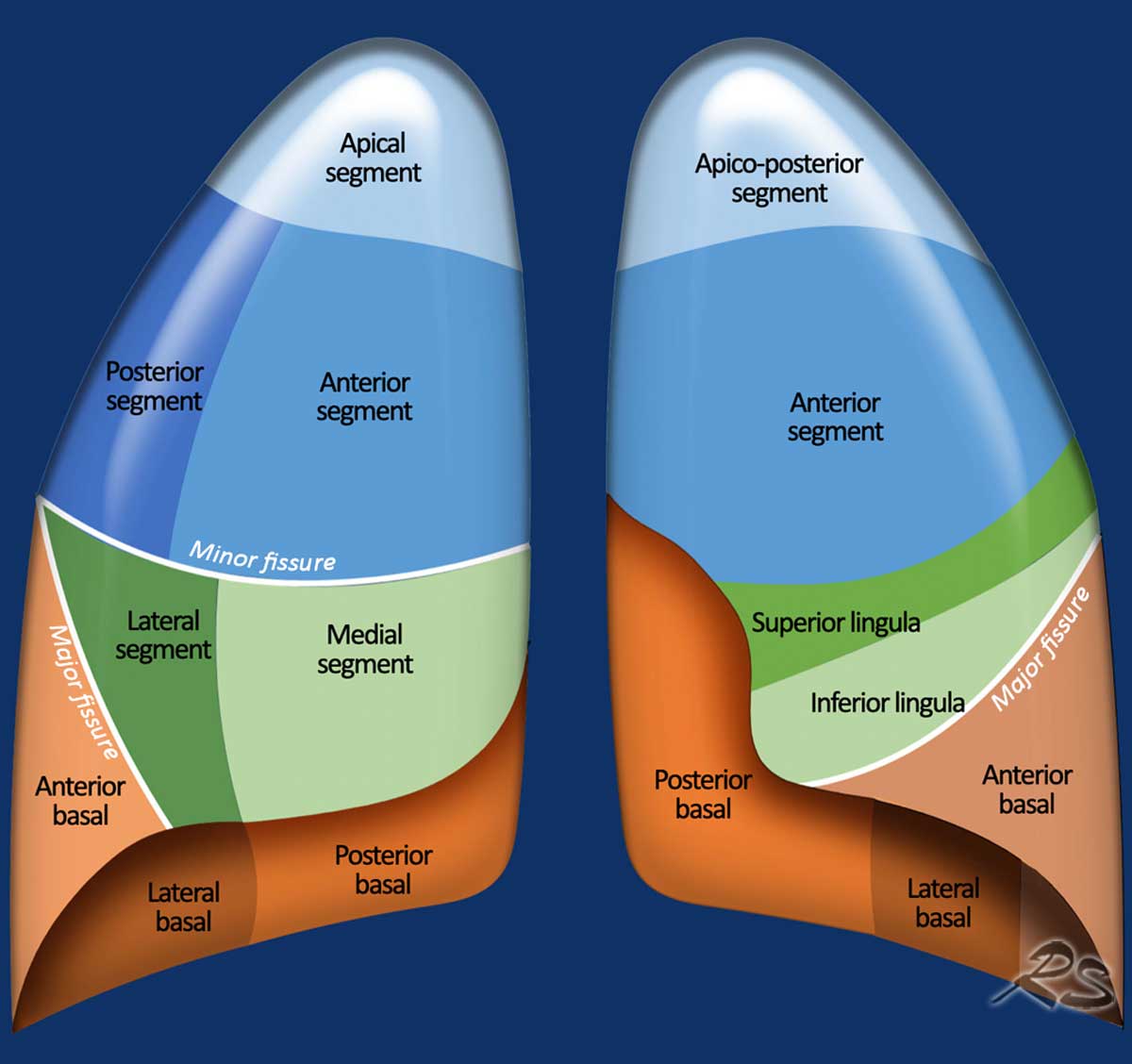 The Radiology Assistant Lung Segments And Bronchi 9000