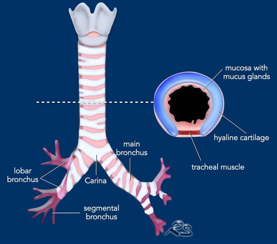 The Radiology Assistant : Large airway disease