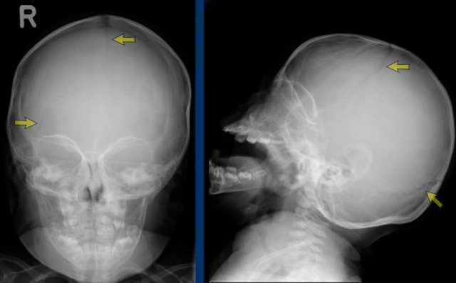 x ray skull anatomy
