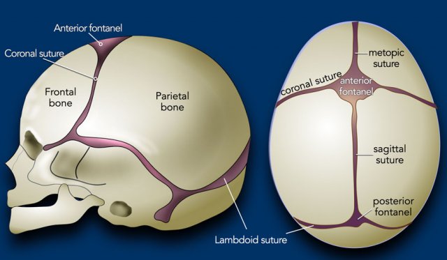 anterior plagiocephaly
