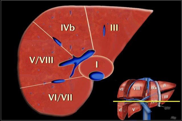 Image at the level of the right portal vein.
