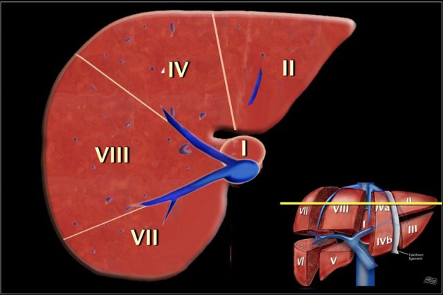 Image at the level of the superior liver segments.