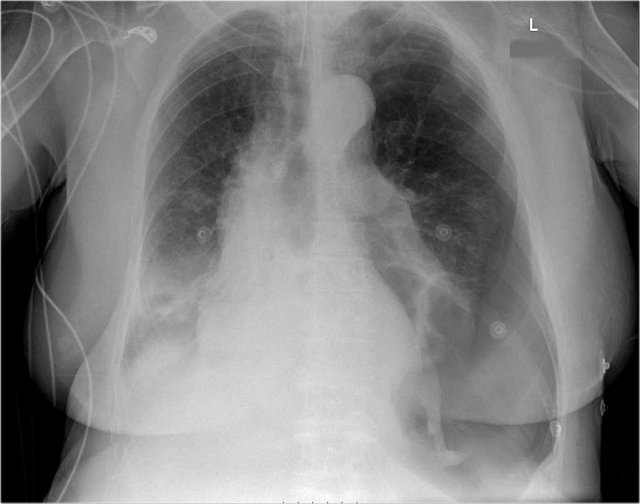 systematic review of chest x ray