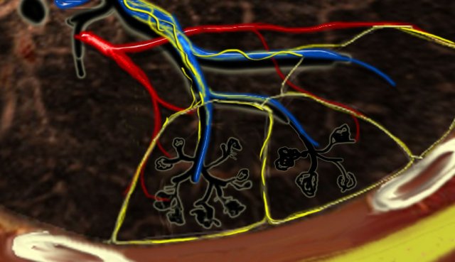 Secundary lobules. The centrilobular artery (in blue: oxygen-poor blood) and the terminal bronchiole run in the center. Lymphatics and veins (in red: oxygen-rich blood) run within the interlobular septa