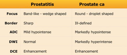 prostate rads prostatitis findings benign radiology