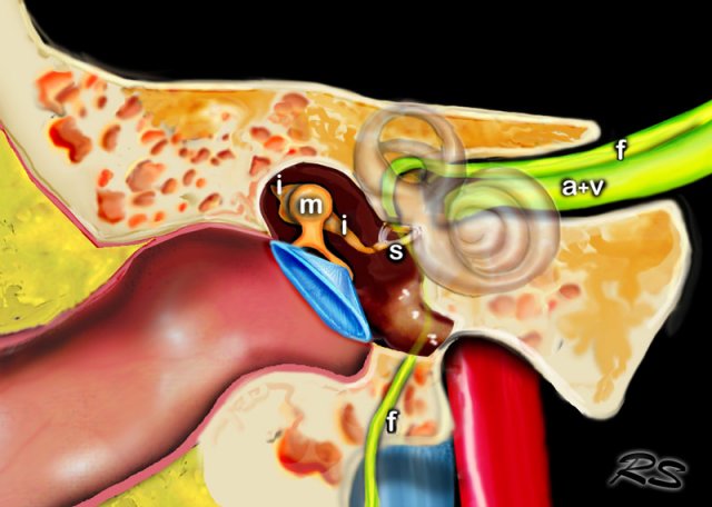 inner ear bone broken