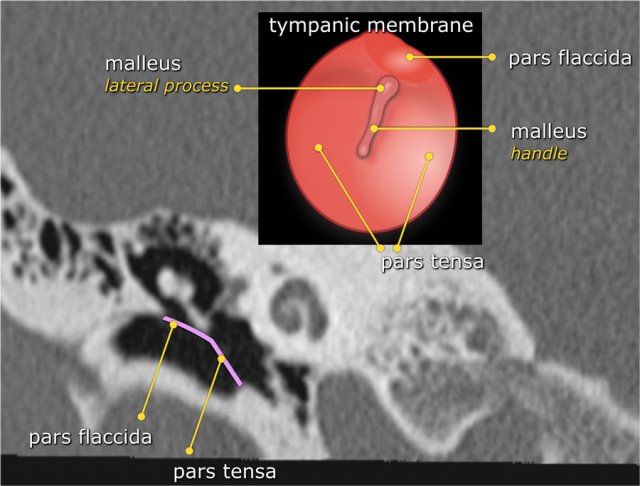 scutum temporal bone